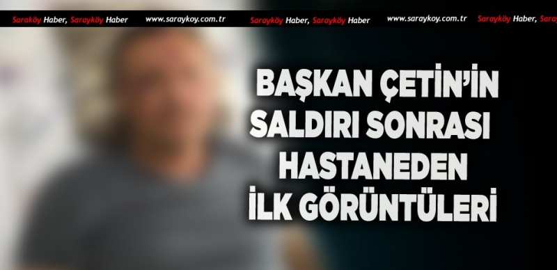 SALDIRI SONRASI BAŞKAN ÇETİN'İN İLK GÖRÜNTÜLERİ 