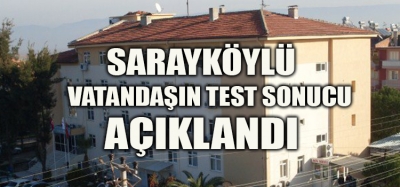 TEST SONUCUNU SOSYAL MEDYADAN AÇIKLADI 